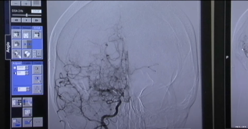 Brain scan of Nao Haroush